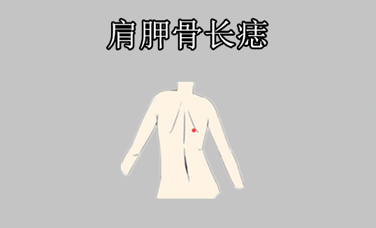 千金难买5颗痣颗颗赚大钱个个升高官有一个就行