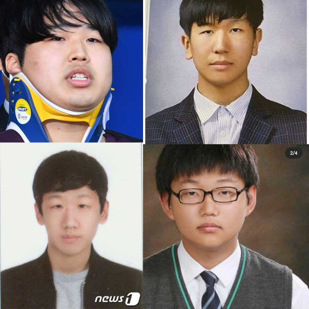 还有去年报道的两个杀人犯,最突出的特征就是鲶鱼嘴.