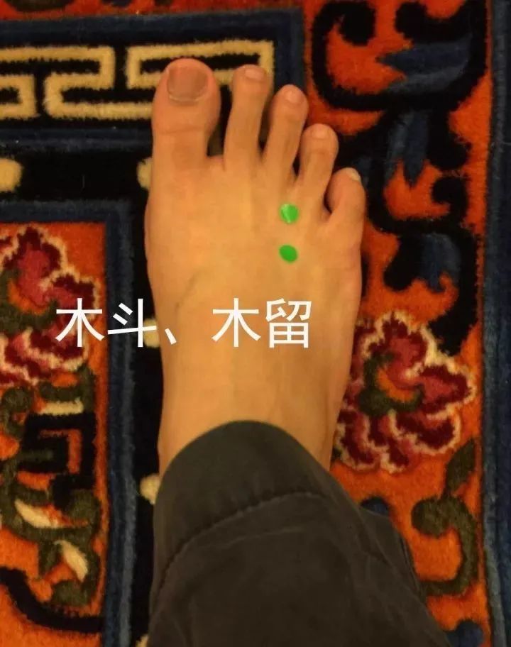 手三火:温暖身心的三把火木斗木留:专治抖不停,留不动手千金,五金