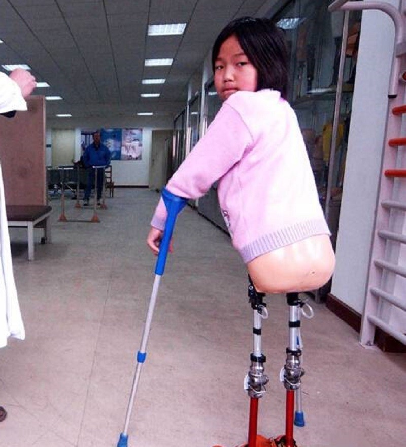 "篮球女孩":4岁失去双腿,13岁拿游泳冠军,曾征战里约残奥会