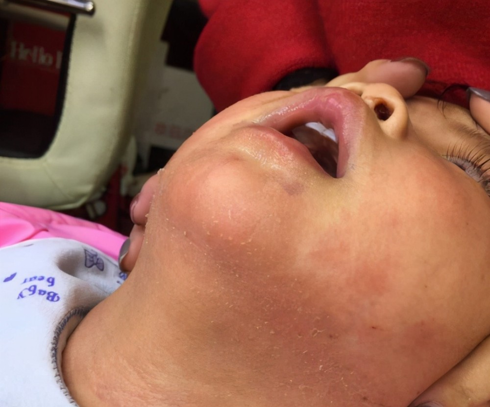 鸡蛋羹不适合作为宝宝的第一口辅食,辅食添加3大原则,新手爸妈要知道