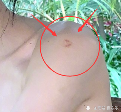 鞠婧祎强凹直角肩却被肩膀处红痕抢镜p图师救场不及