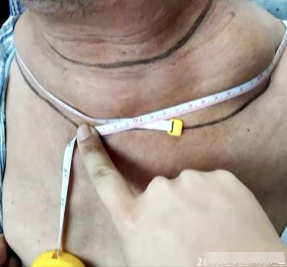 大爷每天喝2斤白酒 "脖子"跟腰一样粗