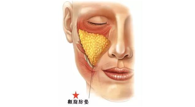 一纹老十岁 说的就是这道法令纹 腾讯新闻
