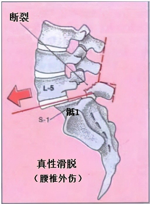 湖南省第二人民醫院何飛平團隊再闖