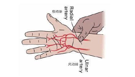 请家人用双手的大拇指分别按压住手掌根部的桡动脉和尺动脉