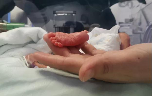 很难想象,三个月前,这个仅在妈妈肚子里仅待了27周就出生的新生儿