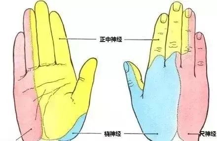 对号入座颈椎病导致不同手指麻木提示不同节段的颈神经受压