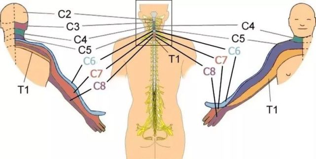 对号入座颈椎病导致不同手指麻木提示不同节段的颈神经受压