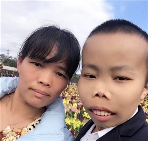 他似乎没有被幸运之神眷顾,因为他从小便患有先天性地中海贫血,相貌也