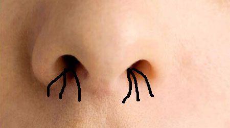 鼻毛应该拔掉还是剪掉,医生解释:大部分人都做错了