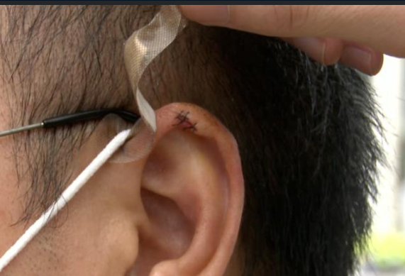 广东一男子理发时耳朵受伤,找店家赔偿,店家:你剪我们一块肉吧