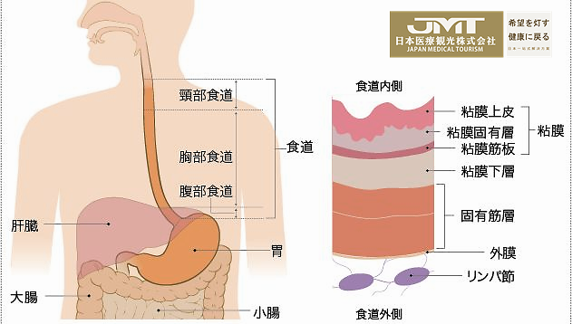Jmt日本癌症治疗 日本临床认证批准opdivo用于治疗食道癌有效 腾讯新闻