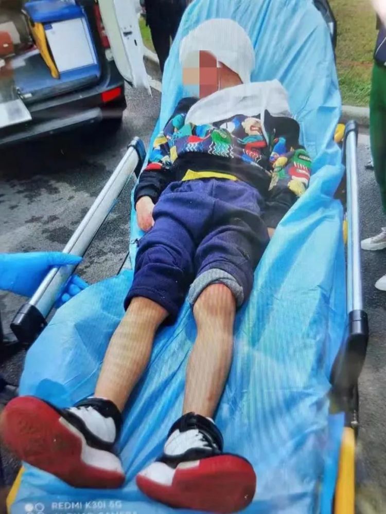 事发时,男孩正骑行滑板车横穿机动车道肇事小车避让不及,最终导致事故
