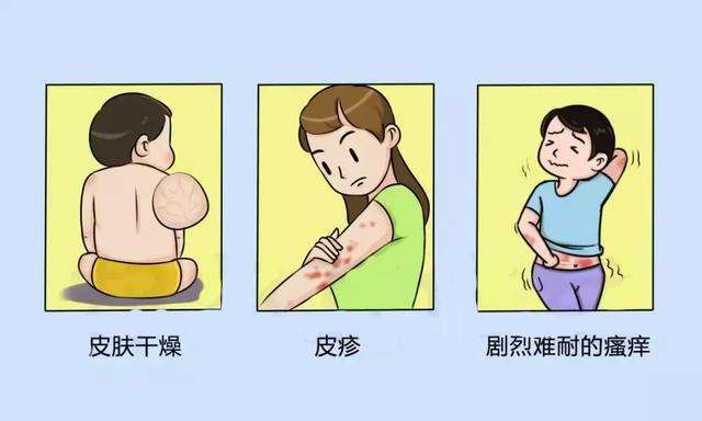 如何避免诱发“特应性皮炎”?从这4点开始!
