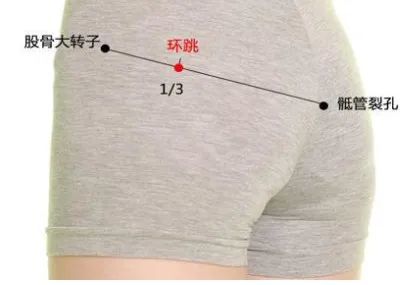 0m穴位侧卧取法:在大转子隆突点与臀裂上端的连线上,当其内2/3与外1/3