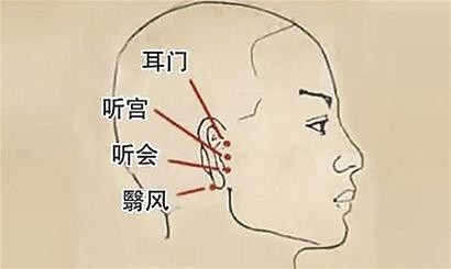 针灸耳鸣如蝉还你耳听八方