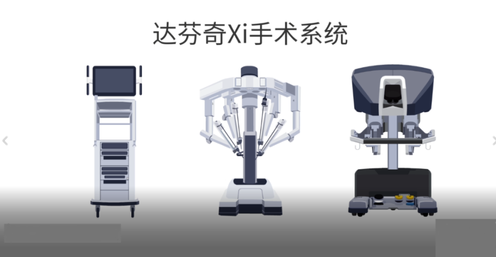 攀枝花首例達芬奇機器人手術成功,患者康復情況良好!