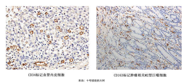 一文带你学习 3 种最常用的免疫组化结果分析方法