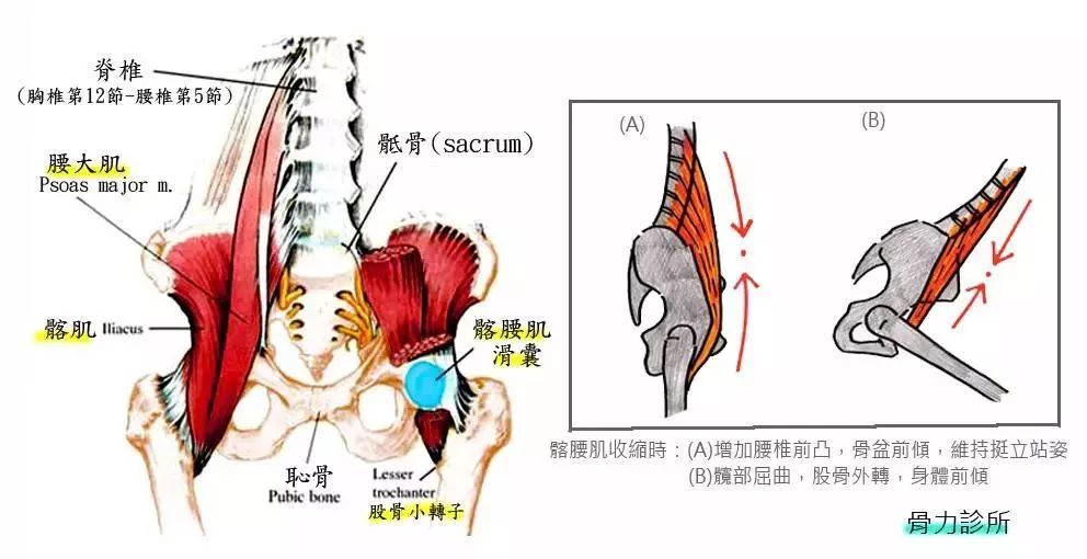 髂腰肌综合症引发的膝关节问题 腾讯新闻