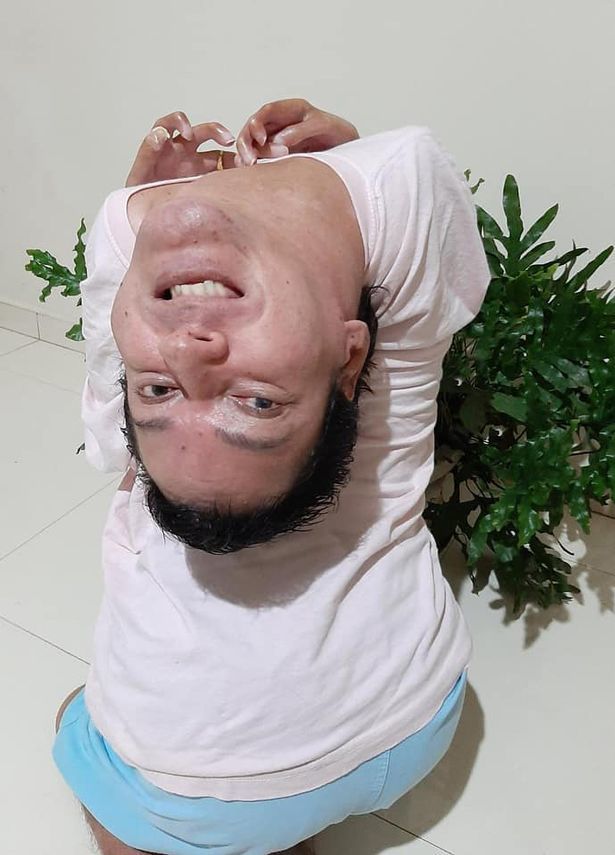 曾经被医生判死刑的人颠倒生活了44年用演讲激励更多人