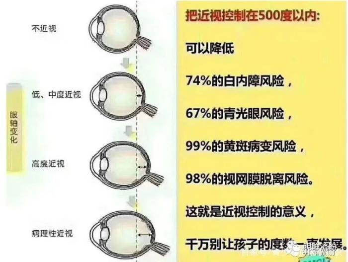 近视的危害有哪些为何家长要重视儿童的视力健康