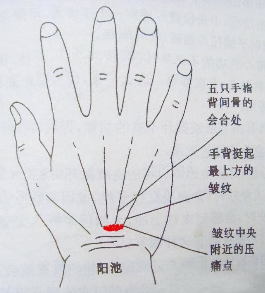 血糖高的人,饭后有3种表现,一个不占,血糖控制得还不错