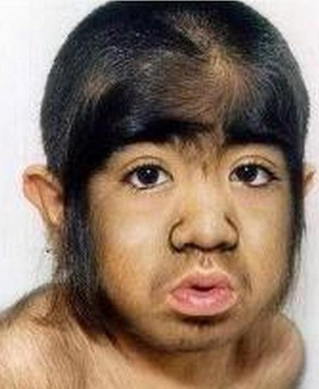 毛孩于震寰全身毛发占90七岁演戏如今娶小13岁美娇妻