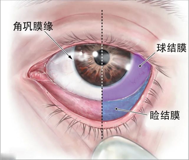 除了黑眼珠之外的整个眼球表面,其实都覆盖着结膜