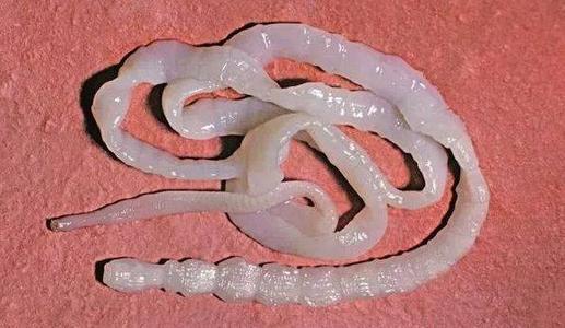 医生介绍说,绦虫种类繁多,男子体内的叫做牛带绦虫,人类是其唯一最终