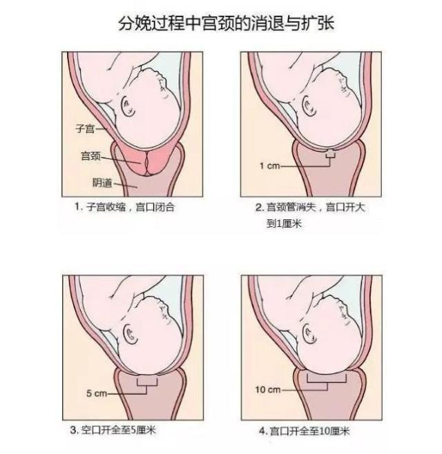 "开指"是指开宫口,专业术语叫"子宫颈口扩张".