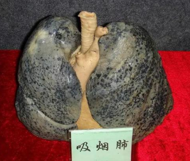 长期吸烟但坚持喝茶的人,身体都有哪些变化?