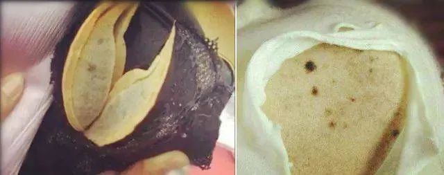 不仅勒,还热,胸前像在"蒸馒头"那该死的束缚感,勒出了无数条红色勒痕