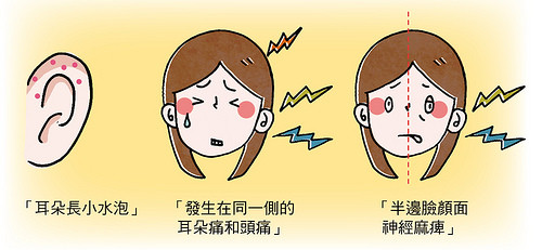 耳鸣原因有3种一直耳鸣怎么办两招舒缓耳鸣症状