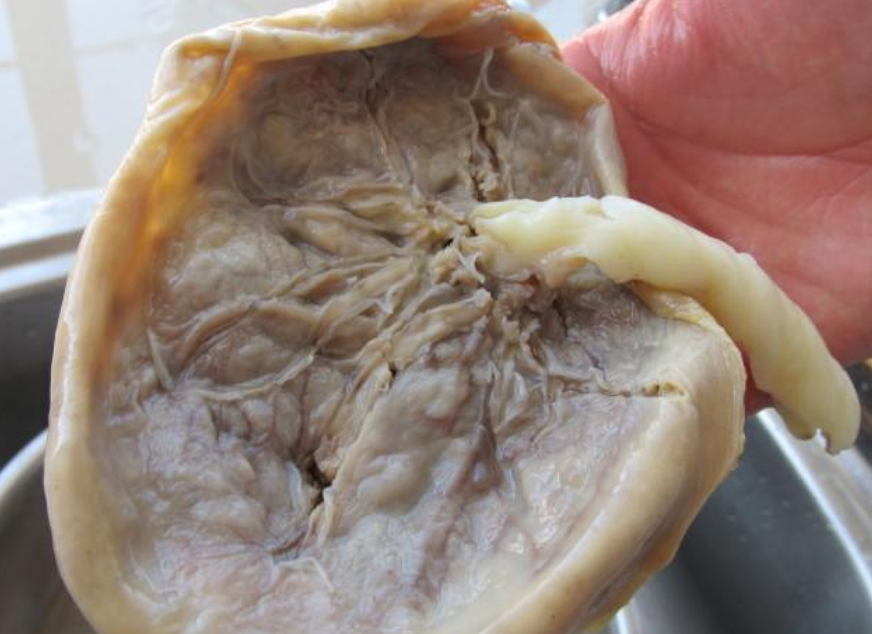 别再无知,医生:"紫河车"并不大补_腾讯新闻