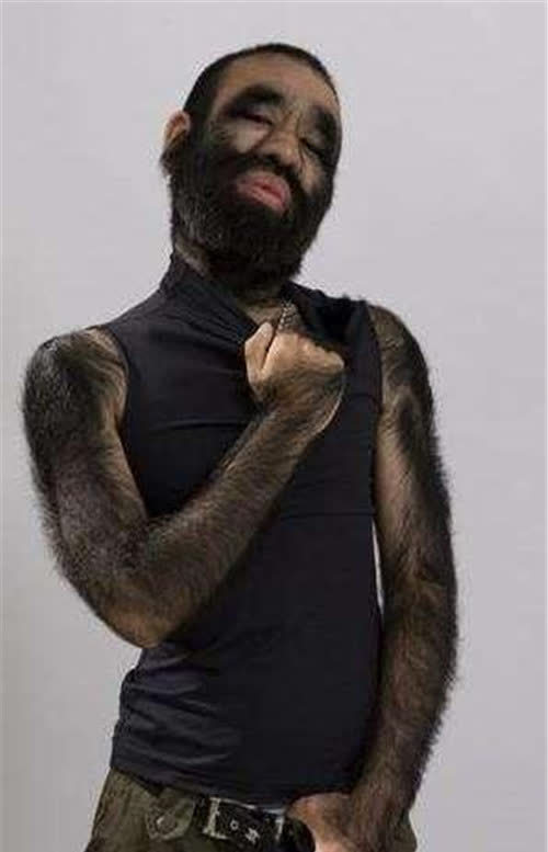 43年了那个曾红遍全国的毛孩于震寰如今他现状如何