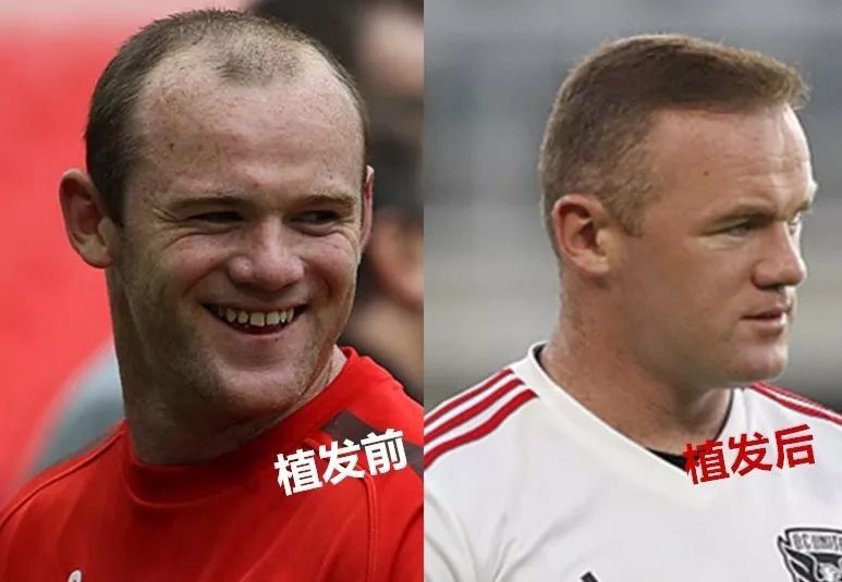 这个诊所的主要业务就是植发(c罗并不秃,难道是受了鲁尼的启发?