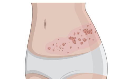 清明出游小贴士别太累当心这条蛇缠身