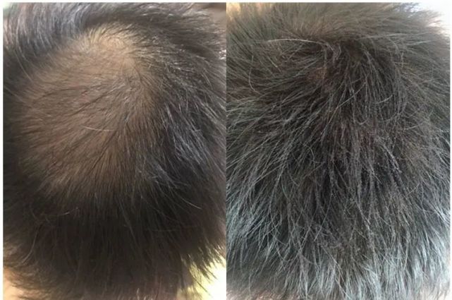 生发养发防脱发