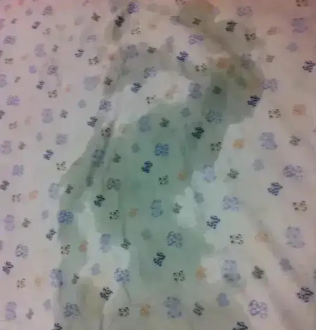 娶了个会尿床的老婆