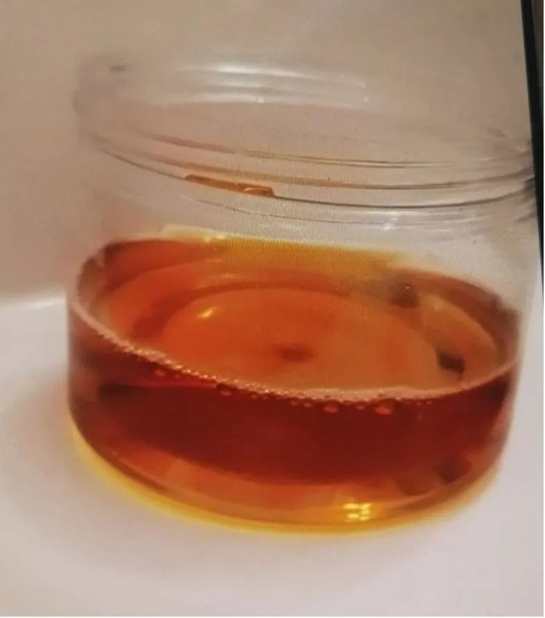 6岁娃吃了包零食结果尿出酱油色这病近期高发