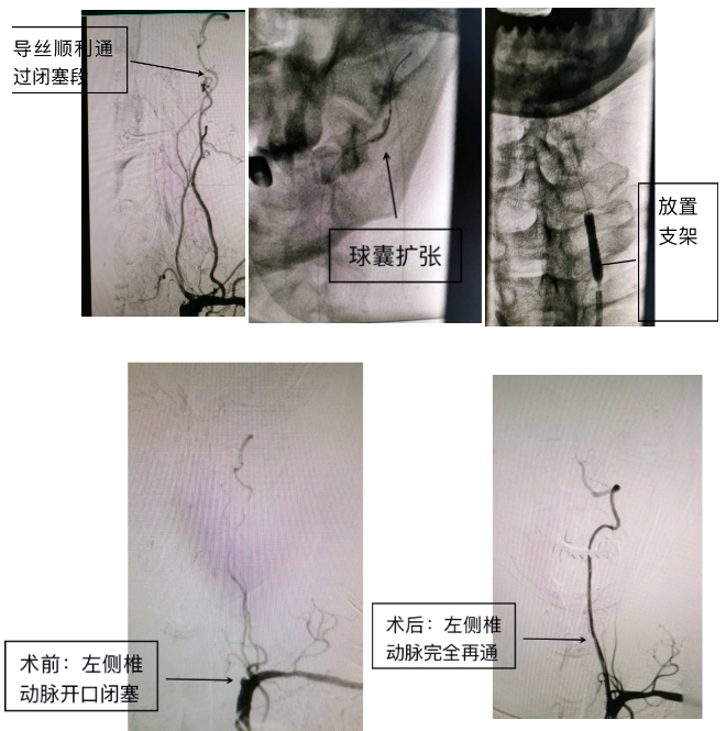 手术费用从十几万降到三万 这位福建名医说 要花最少的钱 做最满意的事 腾讯新闻