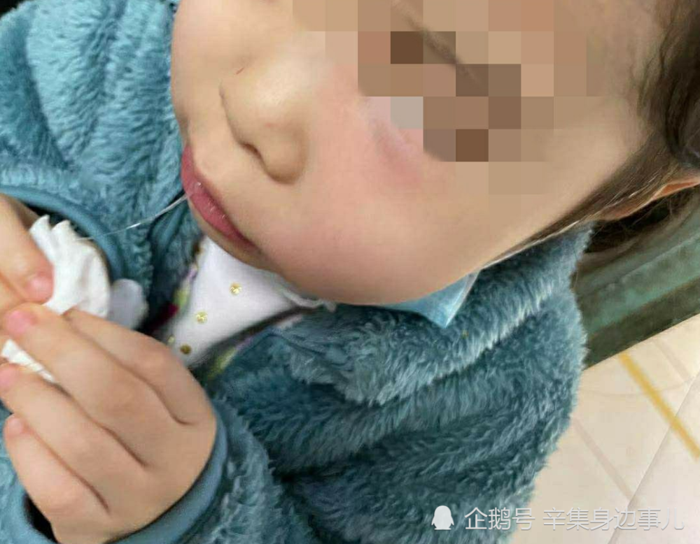 网友曝料石家庄市全博儿童牙科医院治疗后反而出现牙痛脸肿