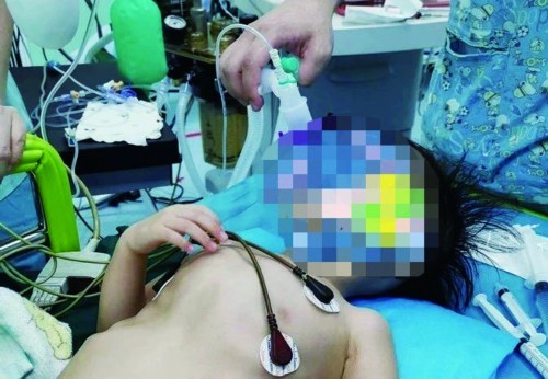 (市儿童医院供图)本报记者 王菁菁日前,市儿童医院小儿心脏病诊疗