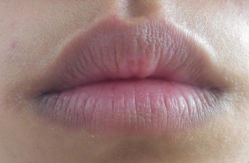 嘴唇颜色不正常这是怎么回事