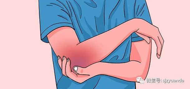 没磕没碰为何身上总有淤青或许与这些原因有关系别忽视