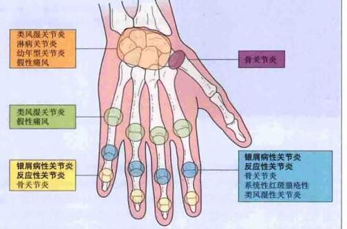 掌趾关节体表位置图图片