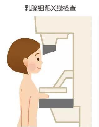 有乳腺癌高危因素的女性,建议将乳腺钼靶筛查的年龄提前至20岁.