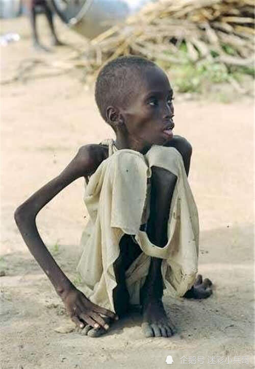 世界欠摄影师一句道歉:照片中饿得只剩皮包骨的女孩,活下来了吗_腾讯