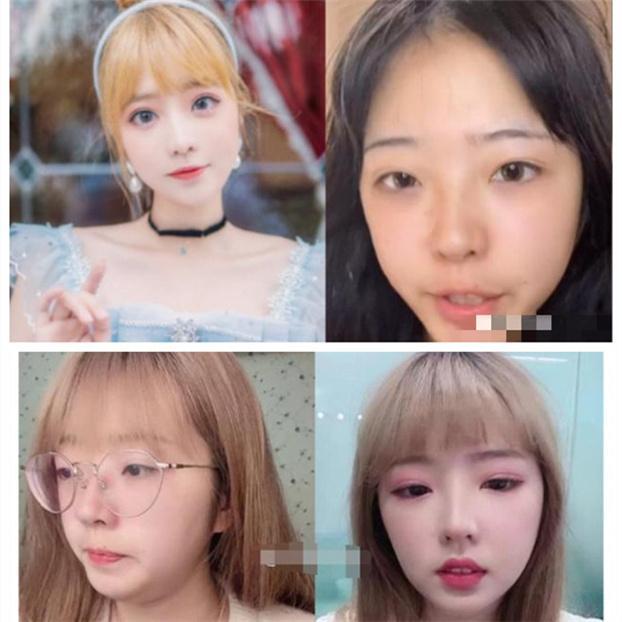 颜值靠整容人设疑造假郝一点和林锡再被网暴令人心疼